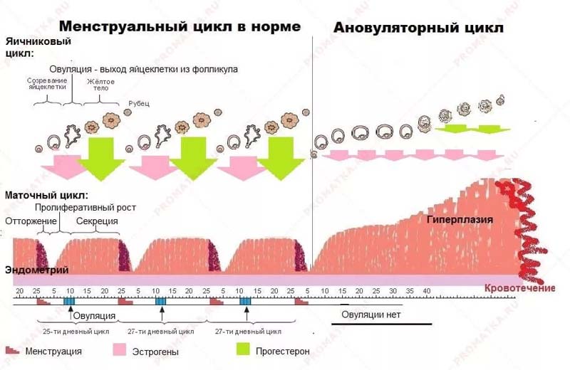 6 способов облегчить жизнь во время менструации